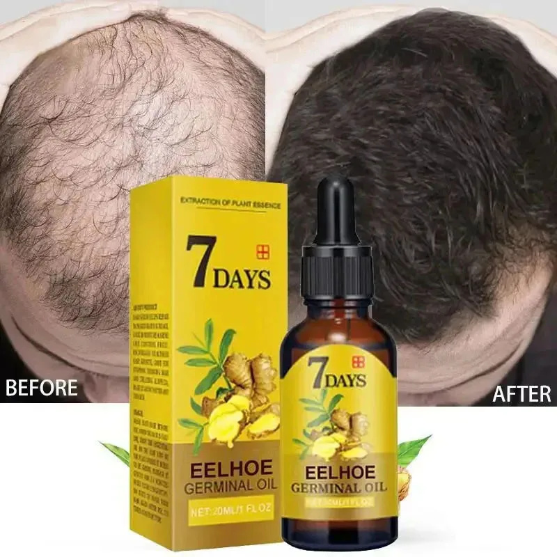 Epidermal Growth Factor - 7 Day Fast Hair Growth Serum