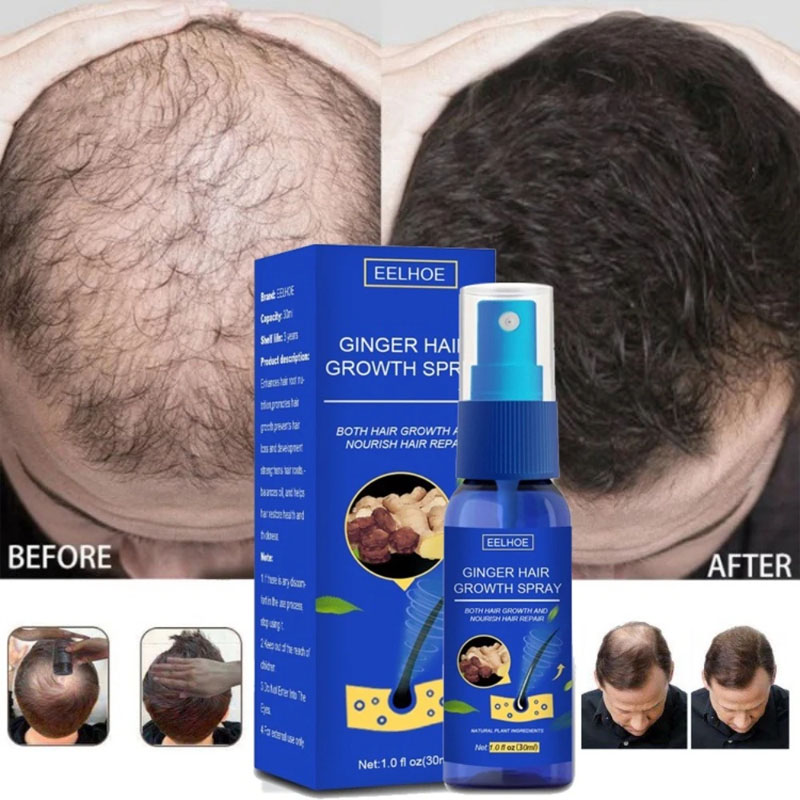 Ginger Hair Growth Serum Spray - Epidermal Growth Factor ulasan dan harga