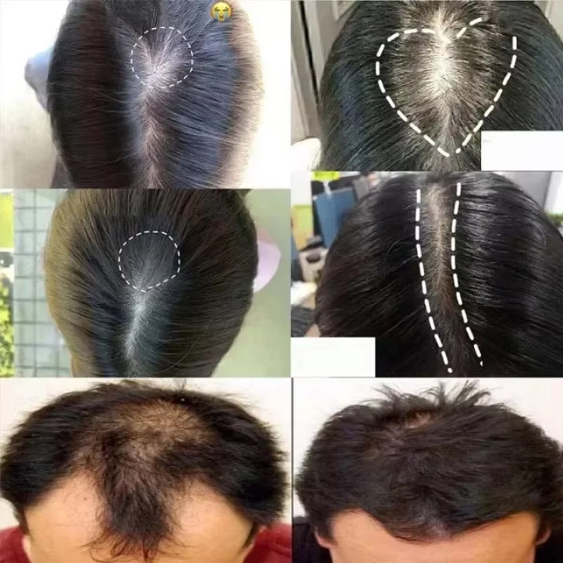 Ginger Hair Growth Serum Spray - Epidermal Growth Factor ulasan dan harga