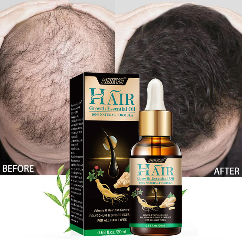 2023 Biotin Fast Hair Growth O - Epidermal Growth Factor ulasan dan harga