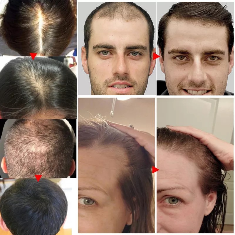 2023 Biotin Fast Hair Growth O - Epidermal Growth Factor ulasan dan harga