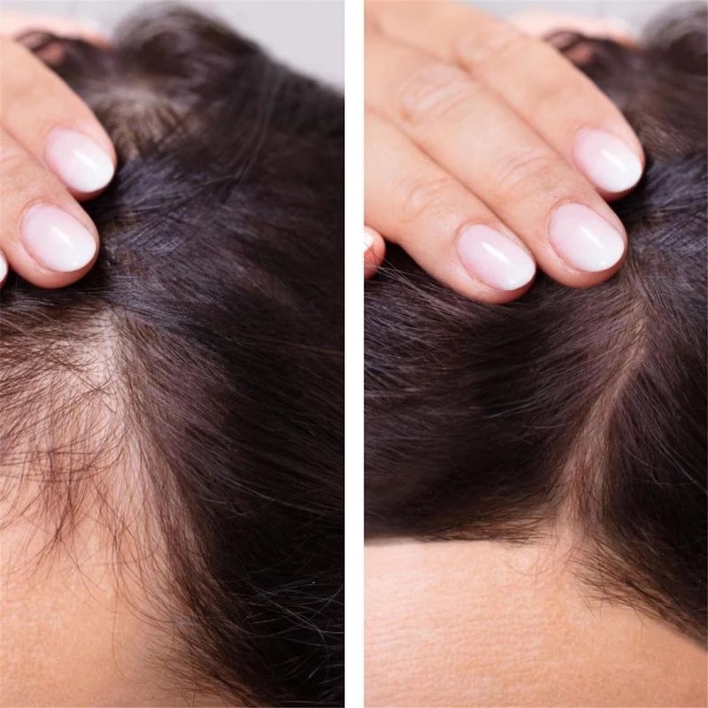 2023 Biotin Fast Hair Growth O - Epidermal Growth Factor ulasan dan harga
