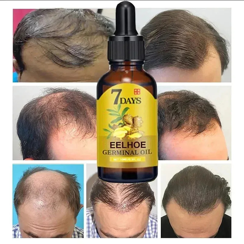 7 Day Fast Hair Growth Serum G - Epidermal Growth Factor ulasan dan harga