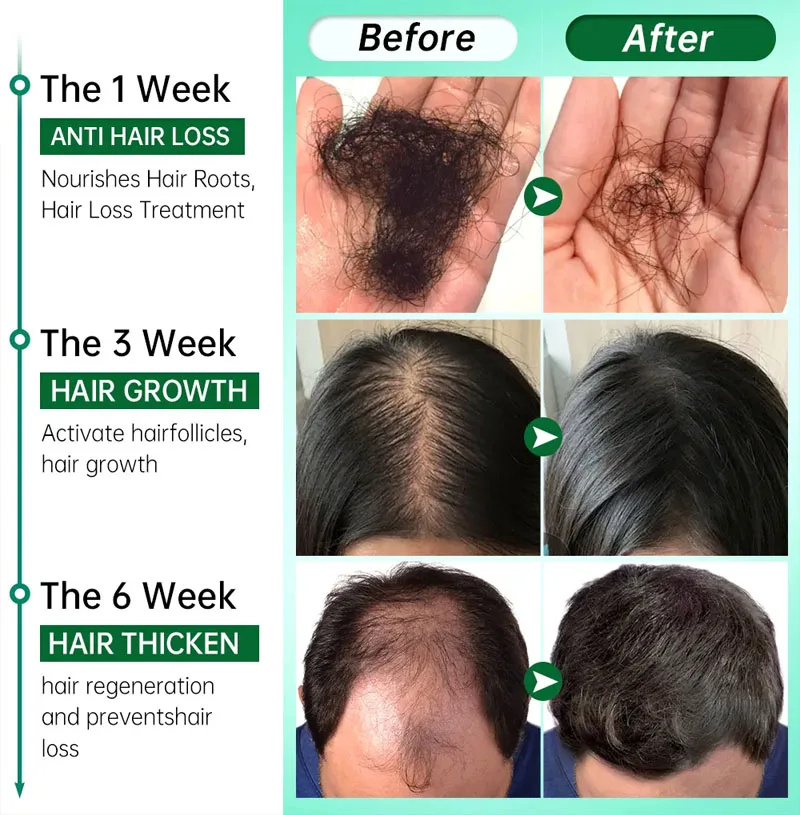 7 Day Fast Hair Growth Serum G - Epidermal Growth Factor ulasan dan harga